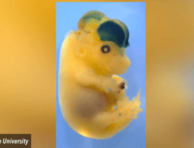 Human DNA Helps Mice Brains Grow Bigger (Video)